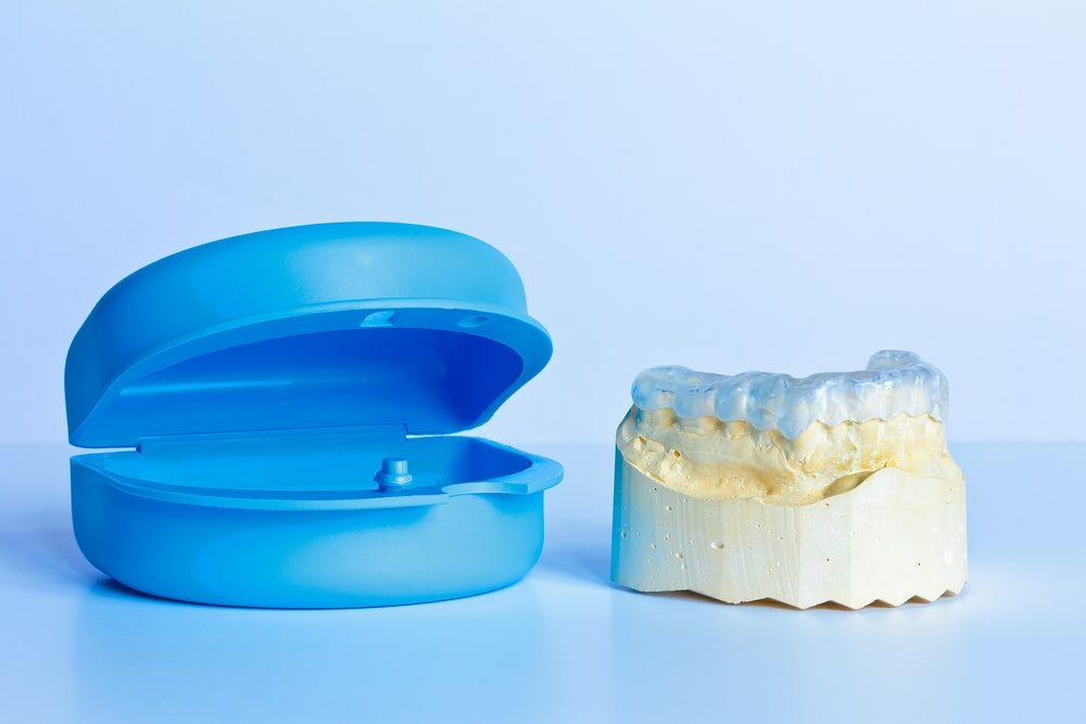 Nightguards Tyler, TX Creative Dental Lab